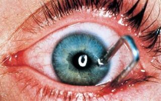 Ранение глаза – все о зрении