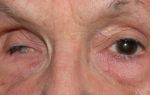 В тобольске внедрена новая технология лечения катаракты – все о зрении