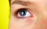 Как сделать красные глаза в домашних условиях – все о зрении
