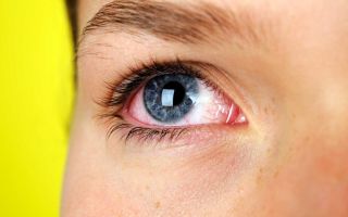Капли от катаракты – инструкции и отзывы – все о зрении