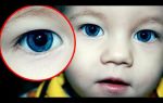 Какой цвет глаз самый редкий? – все о зрении
