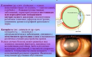 Глаукома и катаракта – все о зрении