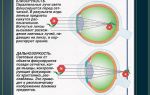 Экстракция катаракты повышает риск отслойки сетчатки – все о зрении