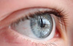 Цвет глаз определяет склонность к заболеваниям кожи – все о зрении