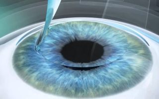 Блины помогут в лечении глаукомы – все о зрении