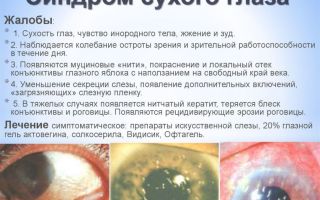 Предложено новое средство для лечения синдрома “сухого глаза” – все о зрении