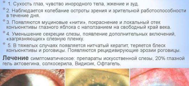 Расширение зрачков – все о зрении