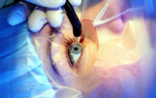 Британские офтальмологи призывают к запрету импорта лазерных указок – все о зрении