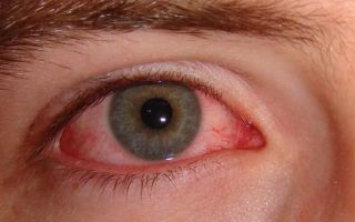 Болезни сосудов могут стать причиной потери зрения – все о зрении