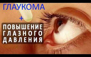 Лечение глаукомы народными методами – все о зрении