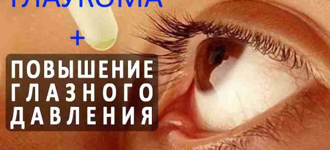 Лечение глаукомы народными методами – все о зрении