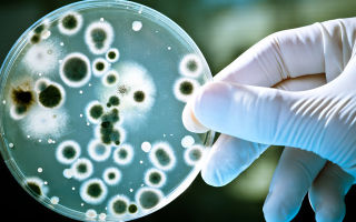 Бактерии – виновники развития трахомы человека – теперь под контролем – все о зрении