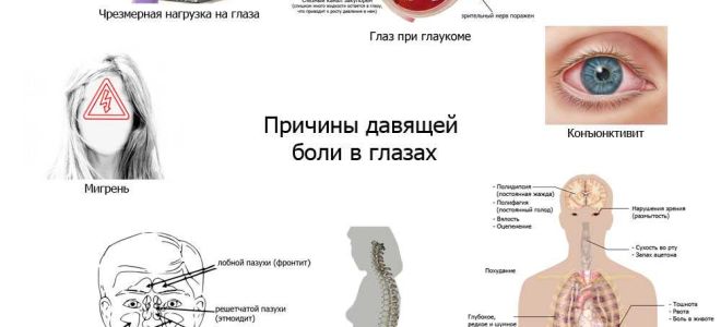 Почему давит на глаза изнутри – все о зрении