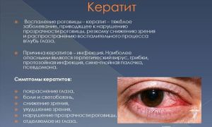 Снижение зрения на один глаз – причины и лечение – все о зрении