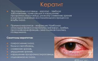 Снижение зрения на один глаз – причины и лечение – все о зрении