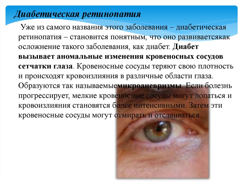 Хронические заболевания зрения. Патологии органов зрения. Инфекционные заболевания глаз.