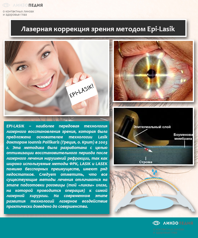 Коррекция зрения цена clinicaspectr ru. Лазерная коррекция зрения. Лазерная коллекция зрения. Л͇а͇з͇е͇р͇н͇а͇я͇к͇о͇р͇е͇к͇ц͇и͇я͇з͇р͇е͇н͇и͇я͇. Лазерная коррекция зрения ласик.